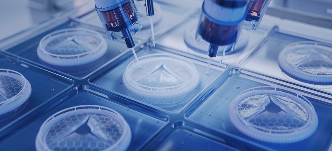 An R&D transformation to become a MedTech industry-leader